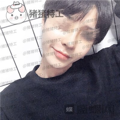 成都西区医院车红昌鼻部手术案例价格分享,惊奇转脸蔡徐坤这波颜值你服吗?