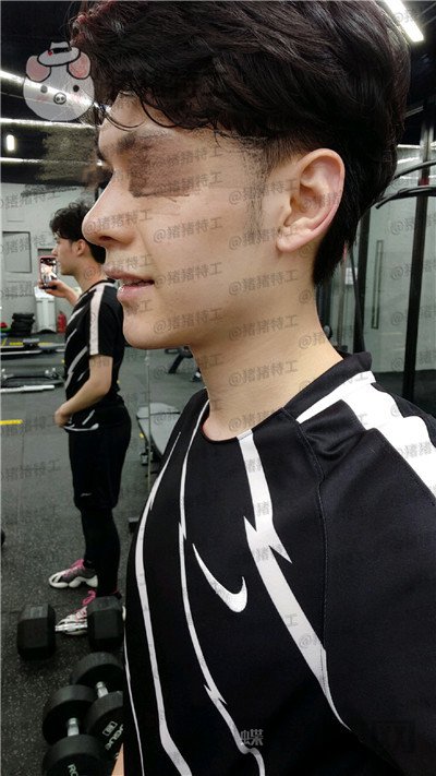北京美莱黄罡隆鼻驼峰鼻修正案例价格分享,论男生有一个好看的鼻子有多重要?