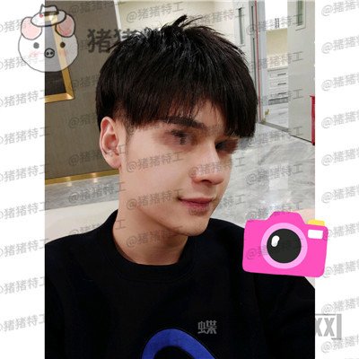 北京美莱黄罡隆鼻驼峰鼻修正案例价格分享,论男生有一个好看的鼻子有多重要?