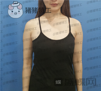 南京美贝尔张永升隆胸案例价格分享,飞机场能做出这样的果真的很惊艳了~