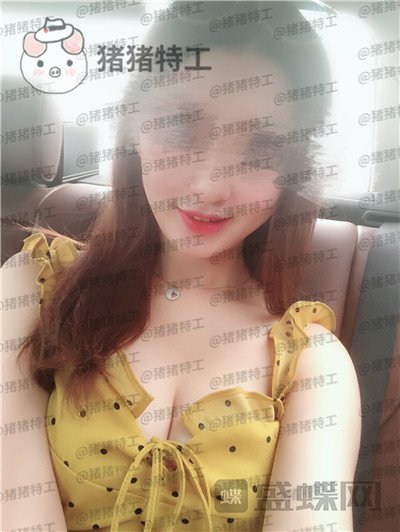 南京美贝尔张永升隆胸案例价格分享,飞机场能做出这样的果真的很惊艳了~