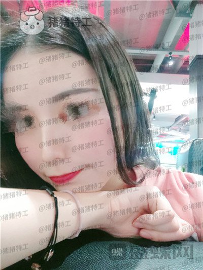 南京美贝尔黄名斗鼻部手术案例价格分享,做完受到太多赞美整个人自信了很多~