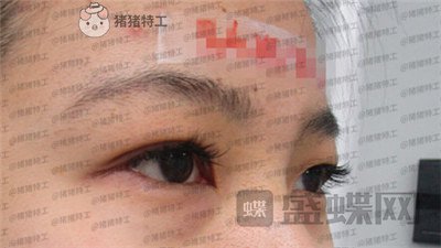 成都素美杨迪眼部手术案例价格分享,拍的照片好多被盗图是因为太好看了吗?