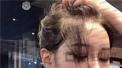 成都素美杨迪眼部手术案例价格分享,拍的照片好多被盗图是因为太好看了吗?