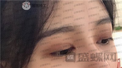 成都素美杨迪眼部手术案例价格分享,拍的照片好多被盗图是因为太好看了吗?