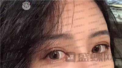 成都素美杨迪眼部手术案例价格分享,拍的照片好多被盗图是因为太好看了吗?