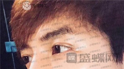 长沙美沃孔伟立双眼皮修复案例价格分享,这是林更新本人吗眼睛太好看了!