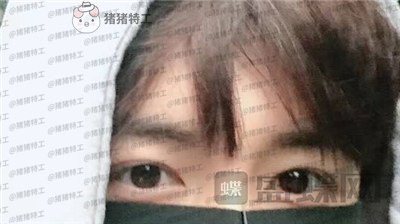 长沙美沃孔伟立双眼皮修复案例价格分享,这是林更新本人吗眼睛太好看了!