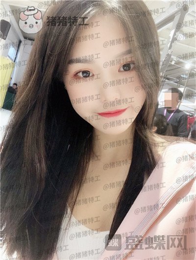 兰州亚韩李军梅隆鼻案例价格分享,做耳软骨隆鼻是一种什么体验?