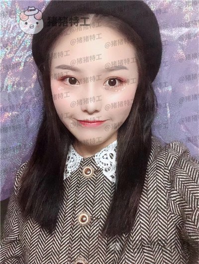 兰州亚韩李军梅隆鼻案例价格分享,做耳软骨隆鼻是一种什么体验?