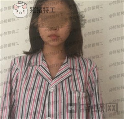 上海美贝尔金关键隆胸案例价格分享,衣显瘦脱衣有肉走路回头率都变高了~