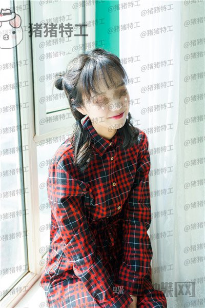 沈阳杏林朱石江下颌角磨骨案例价格分享,磨骨手术好像没有想象中的那么可怕~
