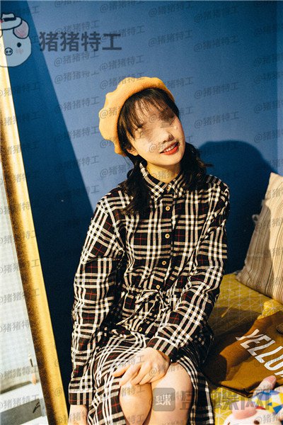 沈阳杏林朱石江下颌角磨骨案例价格分享,磨骨手术好像没有想象中的那么可怕~