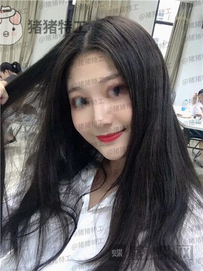 福州爱美尔黄振银隆鼻案例价格分享,没有精致的五官一个鼻子拯救了全部~