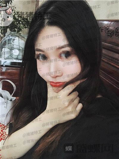福州爱美尔黄振银隆鼻案例价格分享,没有精致的五官一个鼻子拯救了全部~