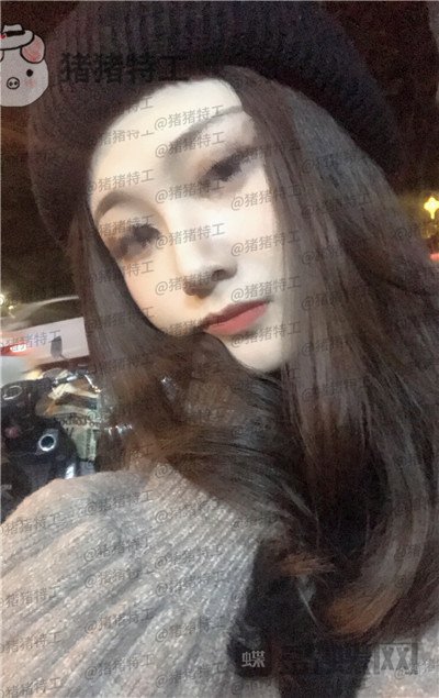福州爱美尔黄振银隆鼻案例价格分享,没有精致的五官一个鼻子拯救了全部~