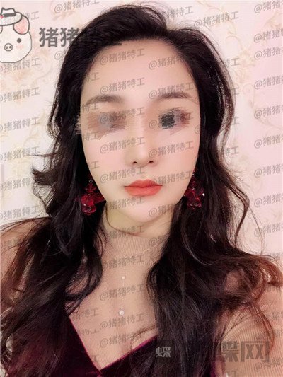 上海愉悦美联臣曹栋弼下颌角整形案例价格分享,脸突然变小这么多我还有点不习惯~