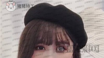 北京百达丽上海九院苏婷双眼皮修复案例价格分享,重获新生的眼睛电力十足~