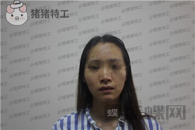 成都西区医院毛健清面部填充案例价格分享,做完像高中生这样年轻可爱的感觉真好~