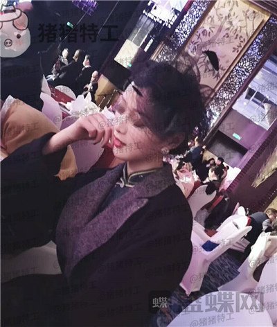 成都西区医院毛健清面部填充案例价格分享,做完像高中生这样年轻可爱的感觉真好~