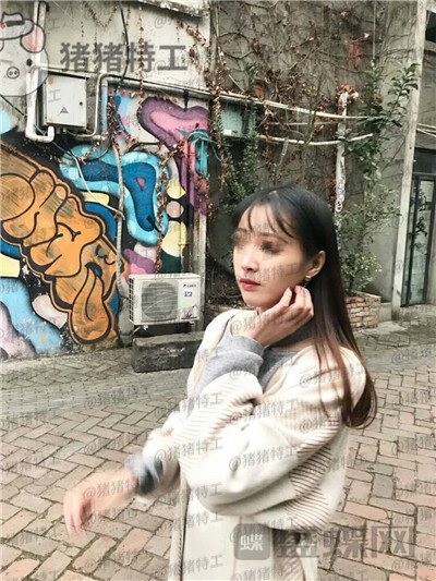 成都西区医院毛健清面部填充案例价格分享,做完像高中生这样年轻可爱的感觉真好~