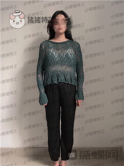 上海愉悦美联臣荣峥吸脂案例价格分享,在上海专门找荣峥医生帮我做的大家帮我参开一下~