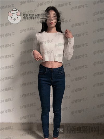 上海愉悦美联臣荣峥吸脂案例价格分享,在上海专门找荣峥医生帮我做的大家帮我参开一下~