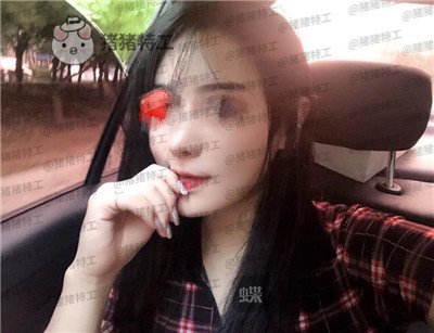 北京壹加壹张绿峰面部填充案例价格分享,脸型确实比以前好看了许多~