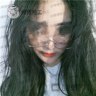 北京壹加壹张绿峰面部填充案例价格分享,脸型确实比以前好看了许多~