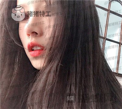 福州美贝尔赵栋材隆鼻案例价格分享,人生就像开了挂一样感谢我的高挺鼻梁~