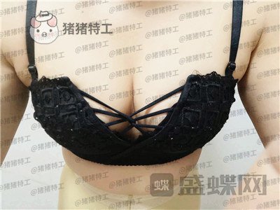 沧州华美白伟枫隆胸案例价格分享,所谓晃动的美丽就是这种果~