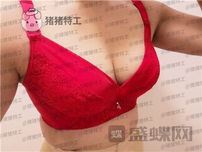 沧州华美白伟枫隆胸案例价格分享,所谓晃动的美丽就是这种果~