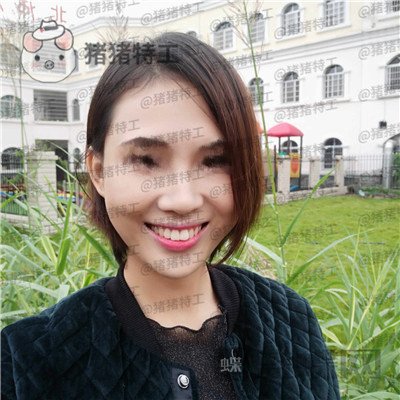 长沙美莱斌鼻部手术案例价格分享,存了好久的钱换来这个鼻子大家帮我看看~