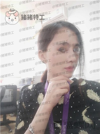 长沙美莱斌鼻部手术案例价格分享,存了好久的钱换来这个鼻子大家帮我看看~