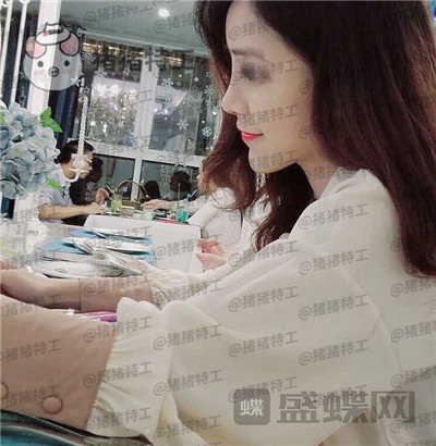 邯郸雅丽刘雅丽隆鼻案例价格分享,做完秒变小仙女好看的鼻子装嫩神器~