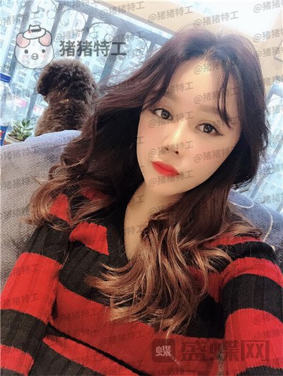 北京炫美徐学东垫鼻基底案例价格分享,老阿姨变身高中生果有点神奇~