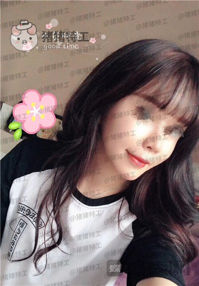 北京炫美徐学东垫鼻基底案例价格分享,老阿姨变身高中生果有点神奇~