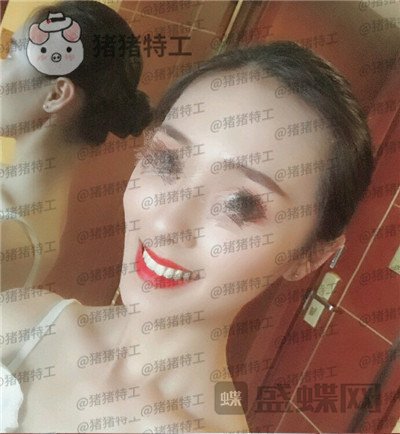 成都博爱李竞男牙齿美白案例价格分享,黄牙妹做完张口大笑再也不自卑~