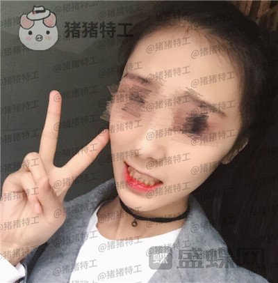 成都博爱李竞男牙齿美白案例价格分享,黄牙妹做完张口大笑再也不自卑~