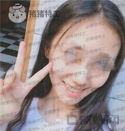 成都博爱李竞男牙齿美白案例价格分享,黄牙妹做完张口大笑再也不自卑~