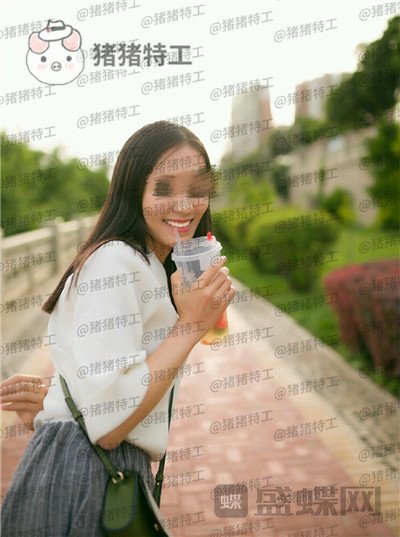 成都博爱李竞男牙齿美白案例价格分享,黄牙妹做完张口大笑再也不自卑~