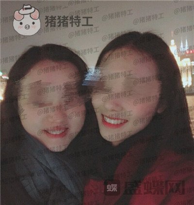 成都博爱李竞男牙齿美白案例价格分享,黄牙妹做完张口大笑再也不自卑~