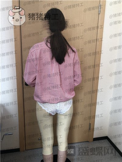 重庆瑞俪胡小义吸脂案例价格分享,又是一起腿玩年系列细长筷子腿get~
