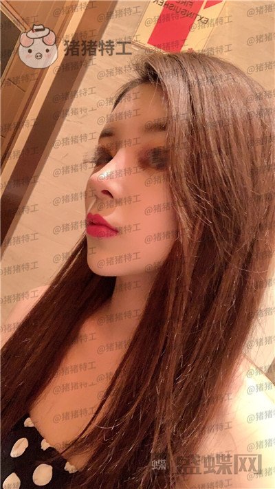 成都西区医院肖凌鼻修复案例价格分享,宝藏女孩做完很御姐范~