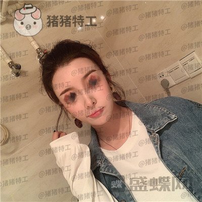 成都西区医院肖凌鼻修复案例价格分享,宝藏女孩做完很御姐范~