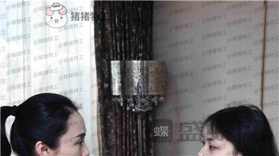 武汉美基元双眼皮案例价格分享,自卑的我终于有了闪闪有神的大眼睛~