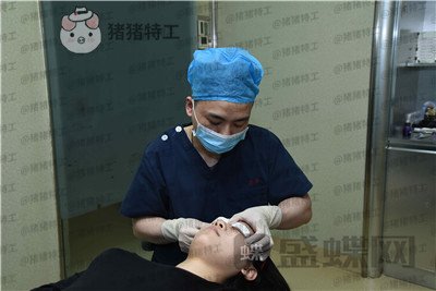 武汉美基元双眼皮案例价格分享,自卑的我终于有了闪闪有神的大眼睛~