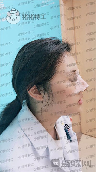 南京华韩奇致裴柄万隆鼻案例价格分享,这家的服务和成果太让我惊讶了~