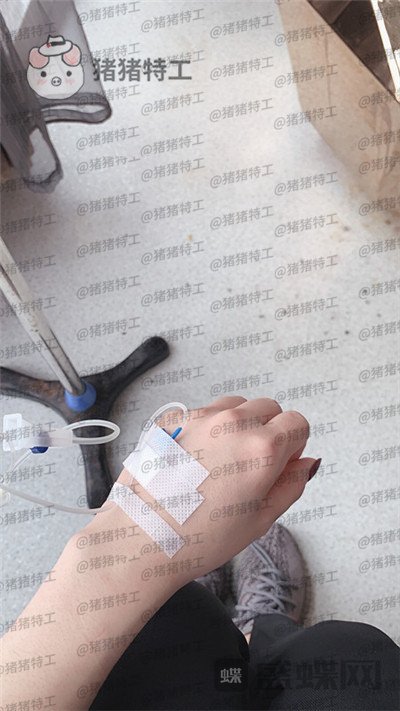 南京华韩奇致裴柄万隆鼻案例价格分享,这家的服务和成果太让我惊讶了~