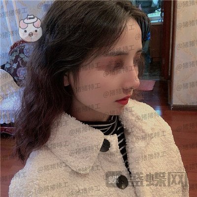 重庆铂生杜亚旭隆鼻案例价格分享,逛街被要签名以为我是某某明星~
